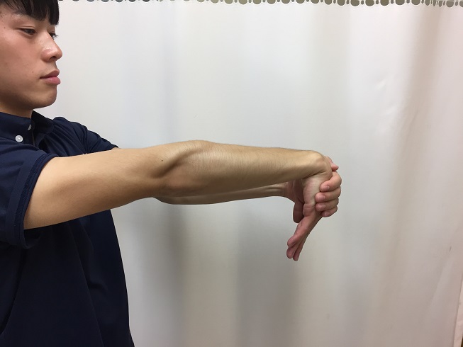 Thrower's elbow 10