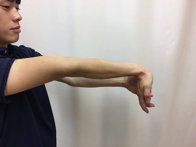 Thrower's elbow 11