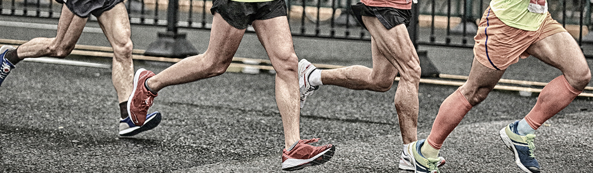 Piriformis Syndrome